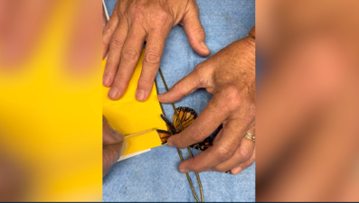 Kelebeğe ikinci şans... Kanat nakliyle yeniden uçtu