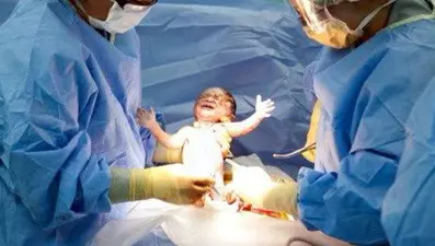 Sezaryen doğumu tercih eden doktor ve hastanelere takip