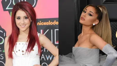 Ariana Grande: Birçok kez botoks yaptırdım