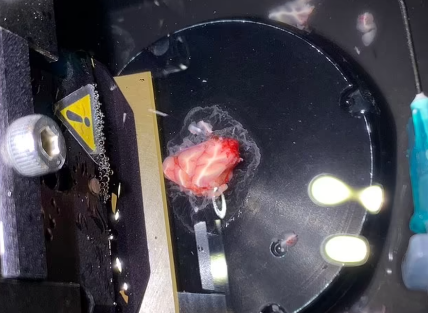 Çığır açan çalışma: İnsan beyninden alınan bir parça ilk kez dışarıda 12 saat boyunca canlı tutuldu 1