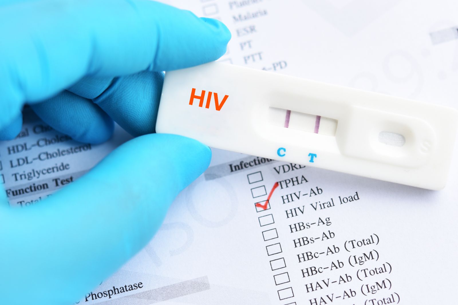 1 Aralık Dünya AIDS günü: Ülkemizde 26 bin 164 HIV tanısı alan hasta var