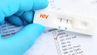 1 Aralık Dünya AIDS günü: Ülkemizde 26 bin 164 HIV tanısı alan hasta var