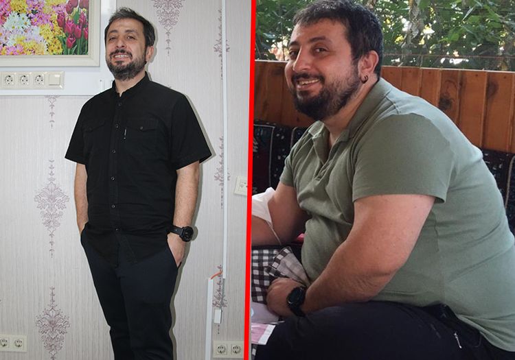 126 kiloydu, 2 yılda 40 kilo verdi: "Gören mide küçültme ameliyatı mı oldun" diyor