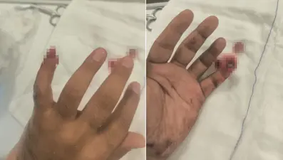 Uyuşturucuyla yakalanan şüpheli, polisin parmağını kopardı