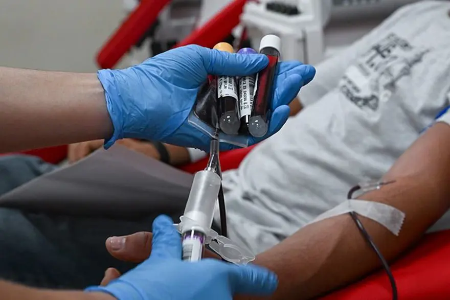 PARMAK KANAMASI ORUÇ BOZAR MI? 8