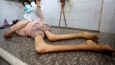 Bir çocuk daha İsrail'in açlık savaşının kurbanı oldu