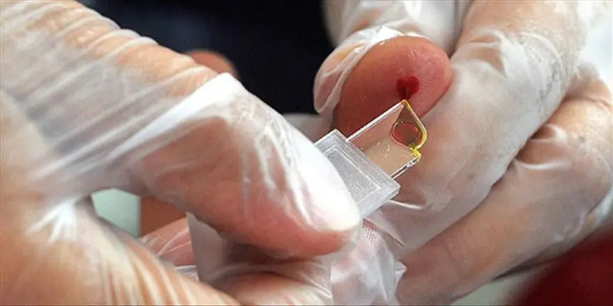 VÜCUTTAN KAN ÇIKARSA ORUÇ BOZULUR MU? 5