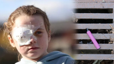 Elektronik sigara patladı, 7 yaşındaki kız gözünü kaybetti