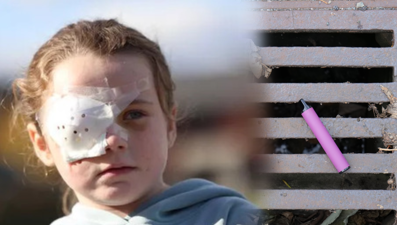 Elektronik sigara patladı, 7 yaşındaki kız gözünü kaybetti