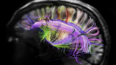 Beynin gökkuşağı haritası