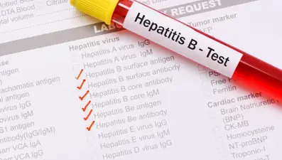 Hepatit B nedir, tanı ve tedavi yöntemleri nelerdir?