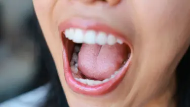 Ölümcül hastalığın erken belirtisi, dil kaslarında ortaya çıkıyor