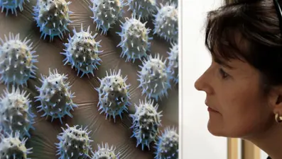 Nörovirüs vakalarında artış: Gıda kaynaklı hastalıkların önde gelen nedeni hakkında ne biliyoruz?