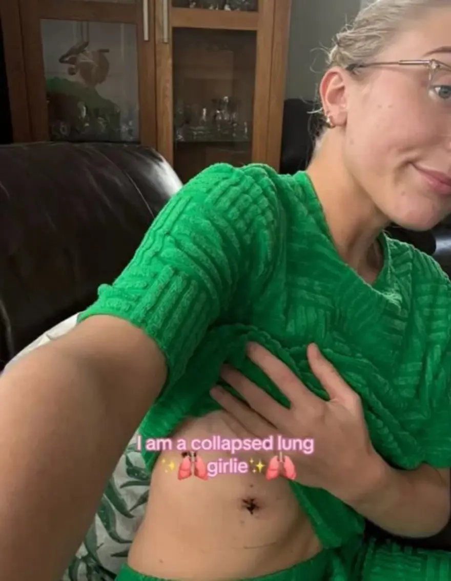 Akciğer sönmesinin 4 işareti: 23 yaşındaki teşhisli hasta anlattı 4