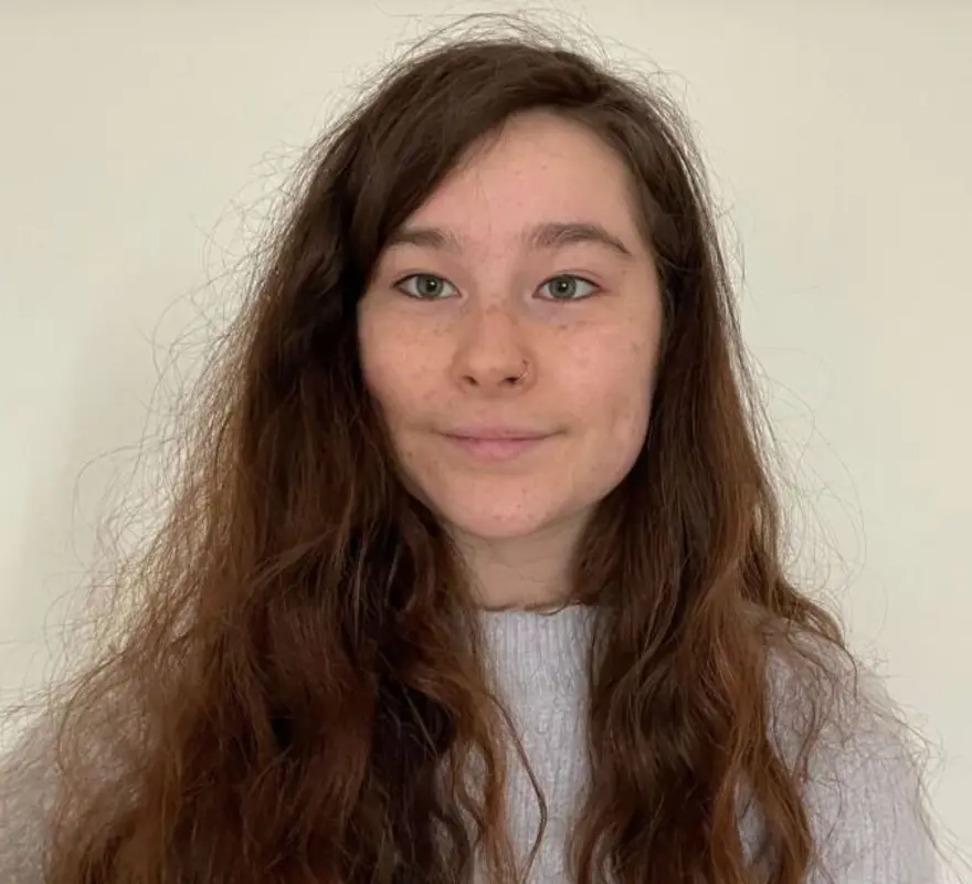 Saçlarını 1 yıldır yıkamıyor: Ailem ve arkadaşlarım deli olduğumu düşünüyor 1