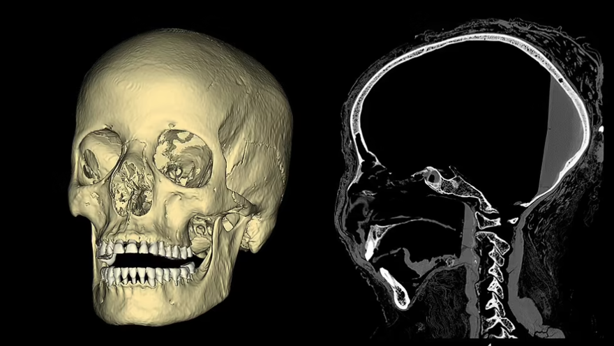 Hamile mumya 2 bin yıl sonra geri döndü: "Gizemli Kadın" tarihe ışık tutacak 4