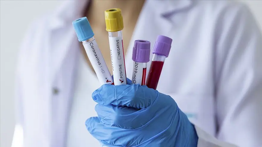 Covid vakalarında artış: Hastanelere başvurular arttı, belirtileri grip ile benzer 1 Covid vakalarında artış: Hastanelere başvurular arttı, belirtileri grip ile benzer 1