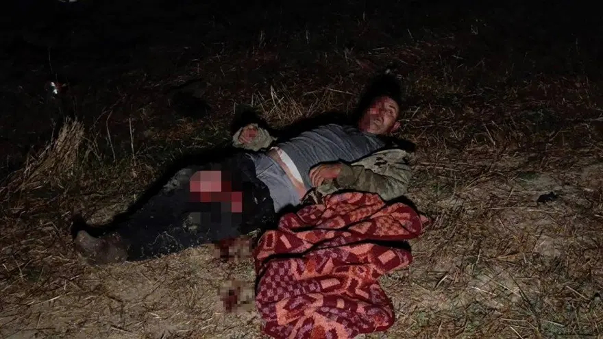 Manavgat'ta aslan saldırısına uğramıştı! Taburcu oldu: "Aslana hakkımı helal ediyorum, onun suçu yok" 2 Manavgat'ta aslan saldırısına uğramıştı! Taburcu oldu: "Aslana hakkımı helal ediyorum, onun suçu yok" 2