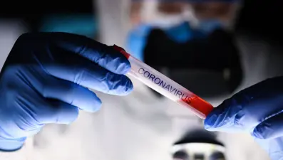 AB: "Covid-19'un kökeni hakkında araştırmacılara tam erişim hakkı verilmeli"