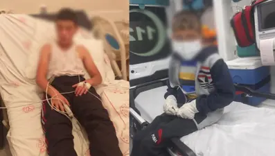 Bitlis'te köpeğin ısırdığı iki çocuktan biri kuduz oldu