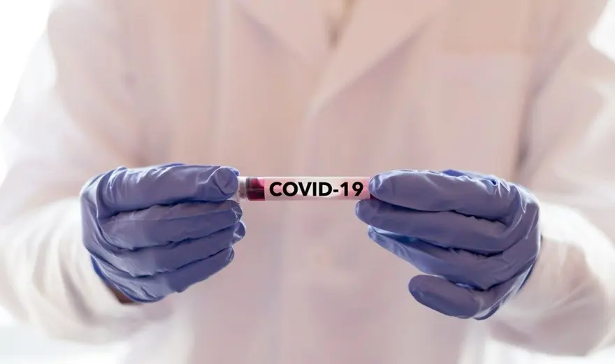 Covid-19 nasıl ortaya çıktı? Yeni iddialar 31