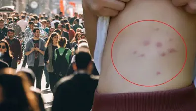 İstanbul'da yaygınlaşan tehlike! Balkon ve bahçelerde su bırakmayın