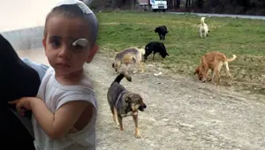 Ağrı'da köpeklerin saldırdığı çocuktan acı haber
