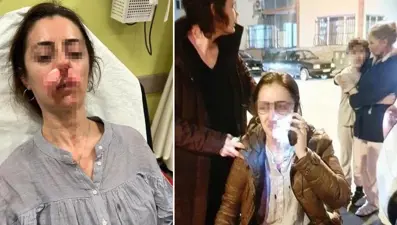 Otomobil kapısı silah sayıldı! Eşinin sevgilisi sandı, arabanın kapısıyla saldırdı