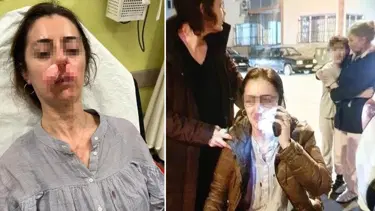 Otomobil kapısı silah sayıldı! Eşinin sevgilisi sandı, arabanın kapısıyla saldırdı