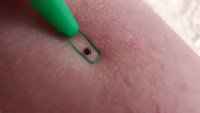 Lyme hastalığı silah olarak mı üretildi? Tartışmalı iddia yeniden gündemde