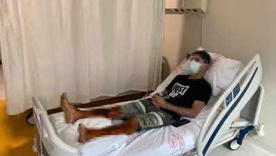 Lavabo açıcı bomba gibi patladı, vücudunun yüzde 35’i yandı