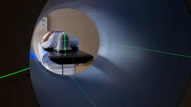 Beyin damar hastalıkları girişimsel radyolojiyle artık kesi olmadan tedavi ediliyor