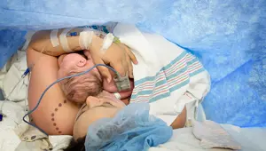 Sezaryen oranları artıyor,  uzmanlar uyarıyor