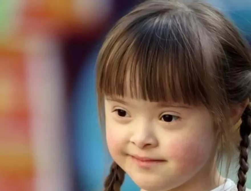 Dünya Down Sendromu Farkındalık Günü nedir, ne zaman kutlanır? 2 Dünya Down Sendromu Farkındalık Günü nedir, ne zaman kutlanır? 2