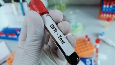 GFR Nedir? GFR kaç olmalı? Yüksekliği ve düşüklüğü nedenleri