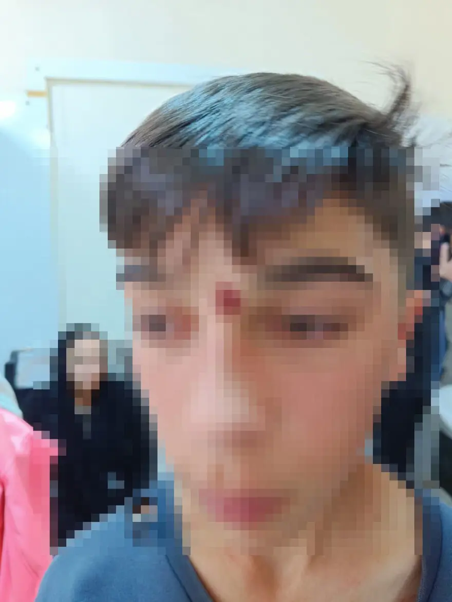 13 yaşındaki öğrenciyi, arkadaşının babası tokatladı 4