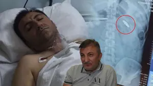 15 Temmuz gecesinden acı miras: Vücudunda kurşunla 9 yıl