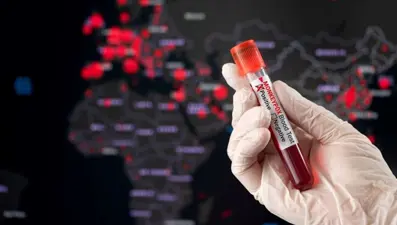 Dünya alarmda! Maymun çiçeği iki ülkede daha görüldü