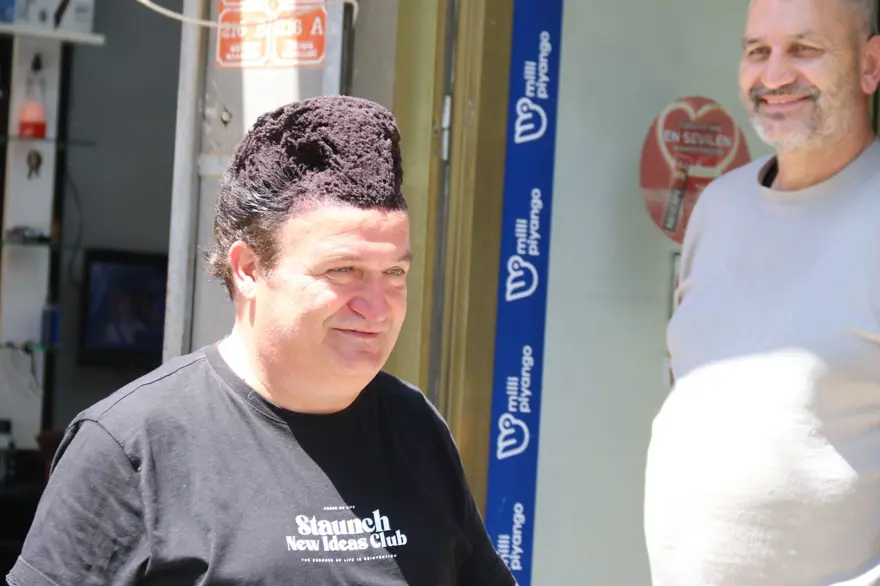 Günde 1 saat uğraşıyor, "kalpaklı" olarak anılıyor! Dökülen saçlarına bulduğu çözüm dikkat çekiyor 7