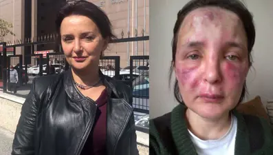 Yüzüne dolgu yaptığı kadının hayatını karartan sahte doktora 3 yıl 4 ay hapis