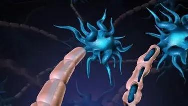 MS (Multipl Skleroz) hastalığı nedir? (MS hastalığı belirtileri ve tedavi yöntemleri)