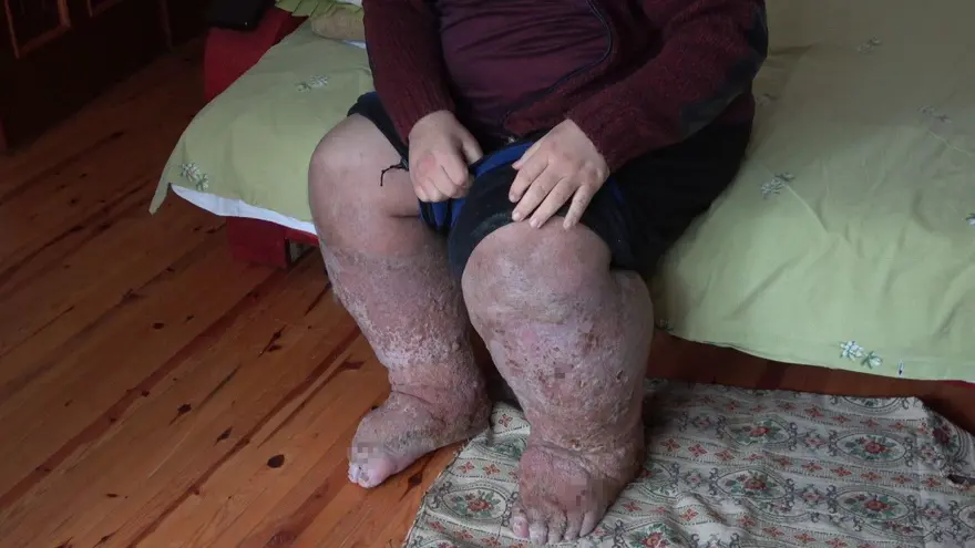 "GÜCÜM KALMADI" 4 "GÜCÜM KALMADI" 4