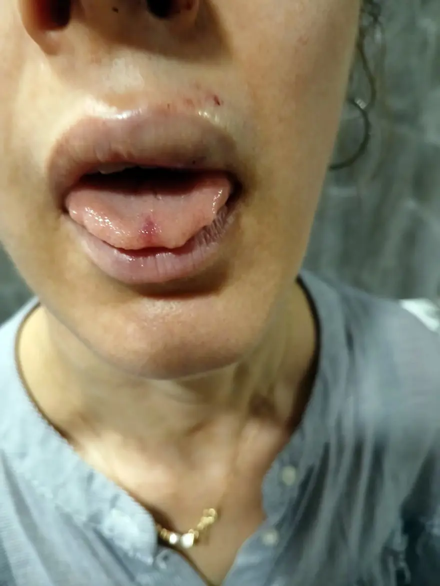 "ÖLÜMLE BURUN BURUNA GELDİM" 7