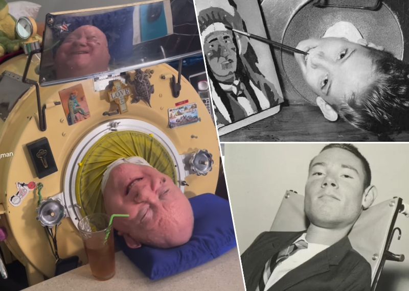 "Demir akciğer" içinde 72 yıl! 78 yaşında hayatını kaybetti