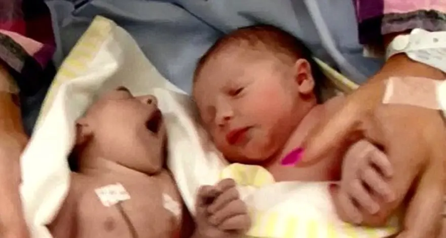 100 dakika yaşadı ama tarihe geçti 1