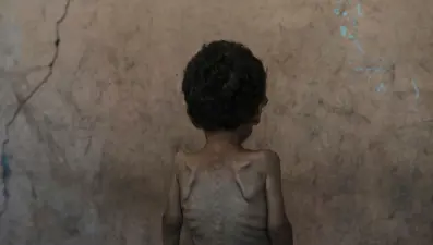 Netanyahu &quot;Gazze&#x27;de kimse açlıktan ölmüyor&quot; dedi: Rakamlar ve tanıklarla gerçekler