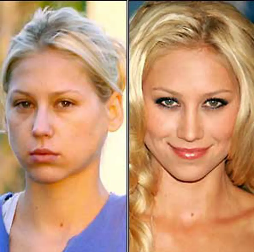 Anna Kournikova 11