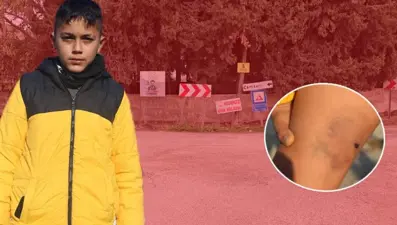 Hatay'da kuduz köpek alarmı! Saldırıya uğrayan çocuk korku dolu anları anlattı: Hiç havlamadan atladı, ısırdı