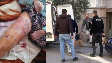 Antalya'da iki Pitbull kadına saldırdı