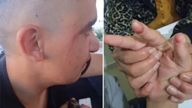 Malatya'da engelli bakım merkezinde dayak iddiası